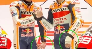 Cedera Retak Tulang Tangan Marc Marquez: Fakta & Pemulihan