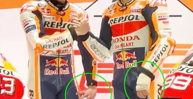 Cedera Retak Tulang Tangan Marc Marquez: Fakta & Pemulihan